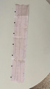 Ekg
